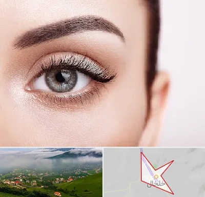 فوق تخصص عنبیه در خلخال