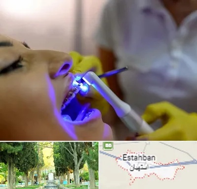 دندانپزشکی با لیزر در استهبان