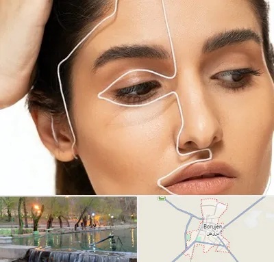عمل بینی اقساطی در بروجن