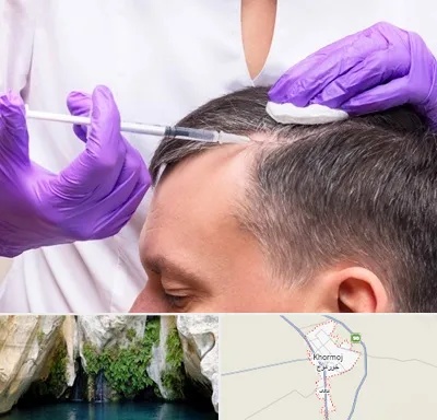 دکتر فوق تخصص پوست و مو در خورموج