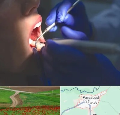 عصب کشی در پارس آباد