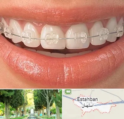 ارتودنسی اقساطی در استهبان