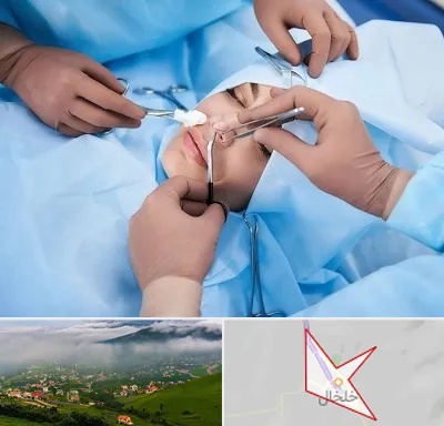 عمل بینی فانتزی در خلخال