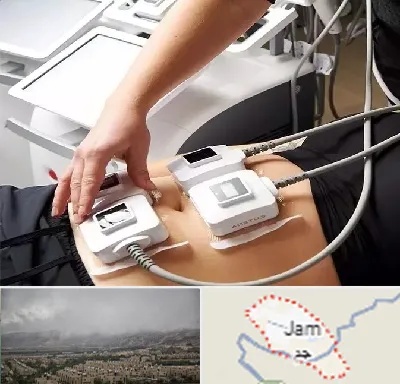 ترواسکالپ در جم