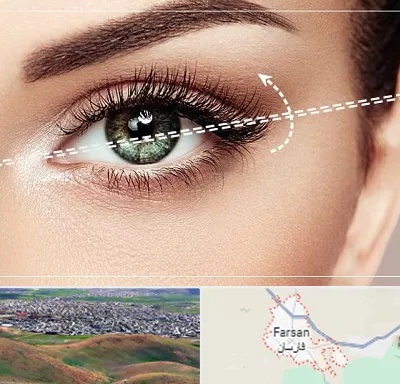 جراحی چشم گربه ای در فارسان