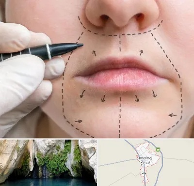 عمل سانترال لب در خورموج