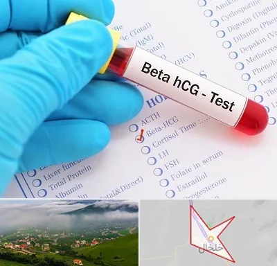 آزمایشگاه بارداری در خلخال