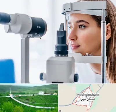 فوق تخصص شبکیه در مشگین شهر