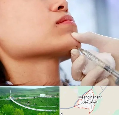 زاویه سازی صورت در مشگین شهر