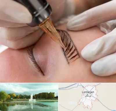 میکروبلیدینگ در لردگان