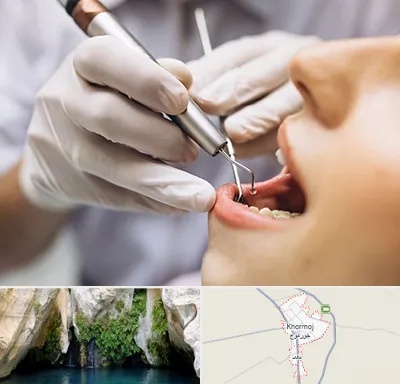 دندانپزشکی ارزان در خورموج
