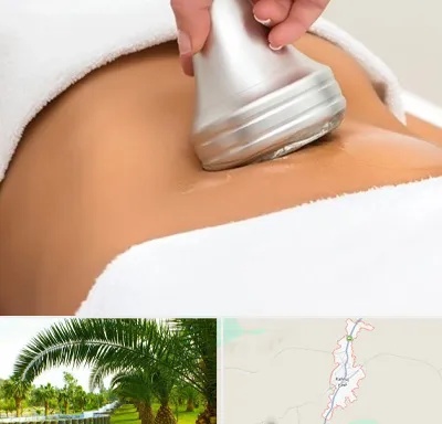 دستگاه لاغری در کهنوج