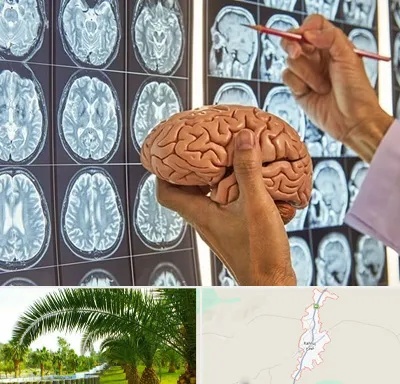 جراح مغز و اعصاب در کهنوج
