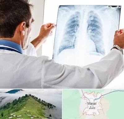 دکتر متخصص ریه در ماسال