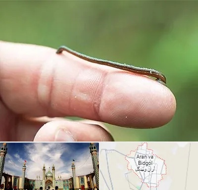 مرکز زالو درمانی در آران و بیدگل