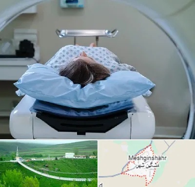 رادیولوژی فک و صورت در مشگین شهر