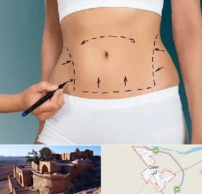 دکتر طب سنتی برای لاغری در قائن