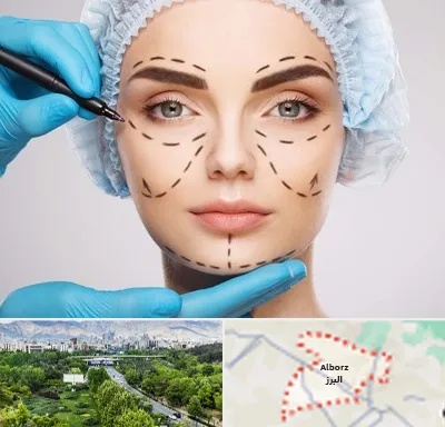 جراح پلاستیک در البرز