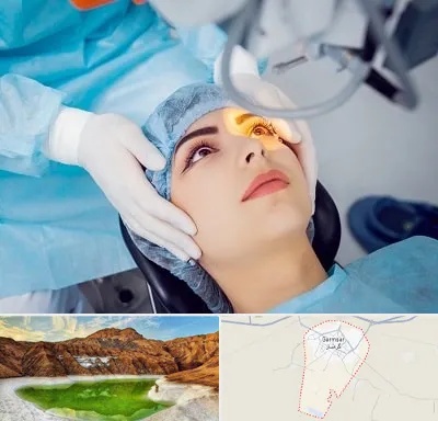 دکتر عمل لیزیک چشم در گرمسار