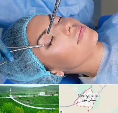 جراحی لیفت ابرو در مشگین شهر