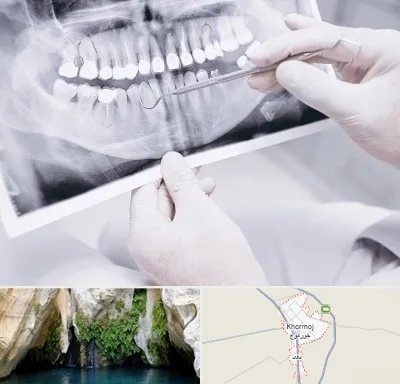 رادیولوژی دهان و دندان در خورموج