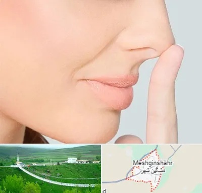 عمل تیپ پلاستی بینی در مشگین شهر