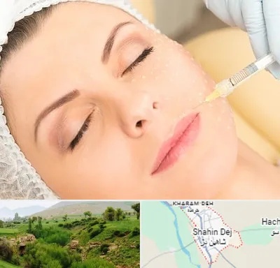 کلینیک تزریق چربی در شاهین دژ