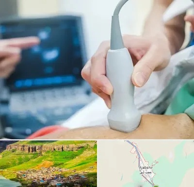 اکو قلب شبانه روزی در عجب شیر