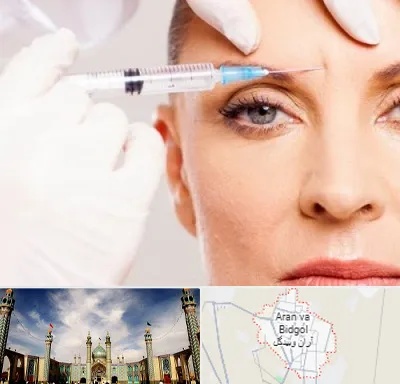 مزوژل در آران و بیدگل