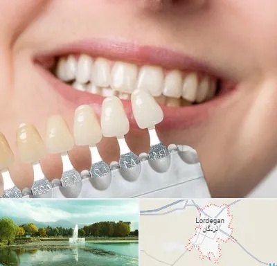 مرکز کامپوزیت دندان در لردگان