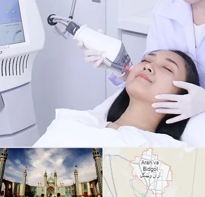 وایتنینگ در آران و بیدگل