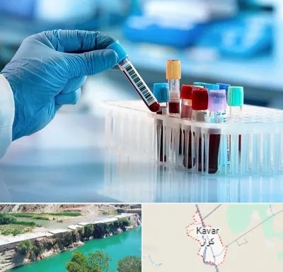 آزمایشگاه خون قبل از ازدواج در کوار