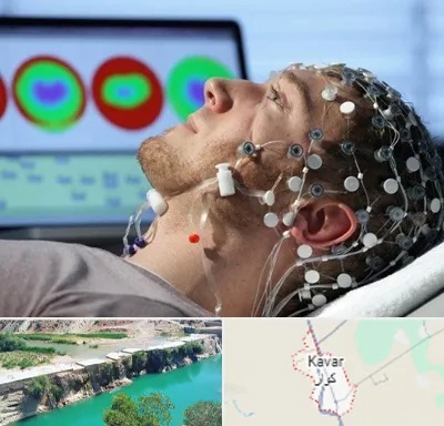 مرکز نوار مغز در کوار
