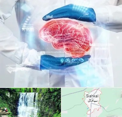 دکتر مغز و اعصاب در سیاهکل