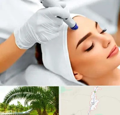 آموزش مزوتراپی در کهنوج