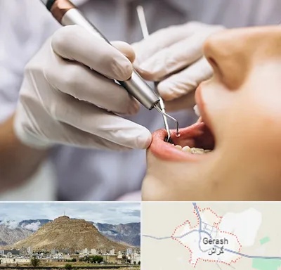 دندانپزشکی ارزان در گراش