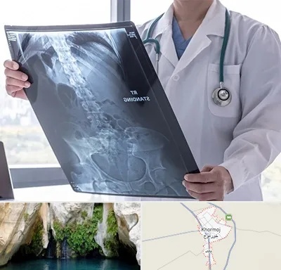 رادیولوژی شبانه روزی در خورموج