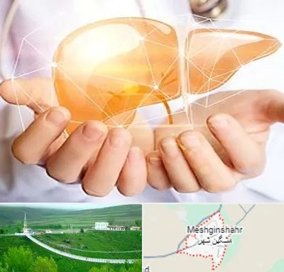 دکتر سرطان کبد در مشگین شهر