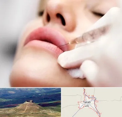 کلینیک تزریق ژل لب در تکاب