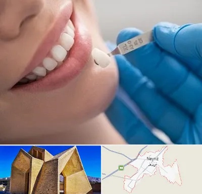 مرکز لمینت دندان در نی ریز