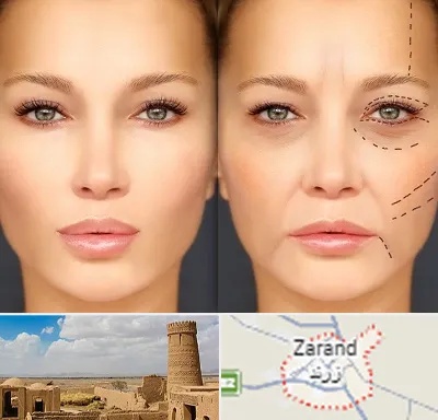 متخصص زیبایی چشم در زرند