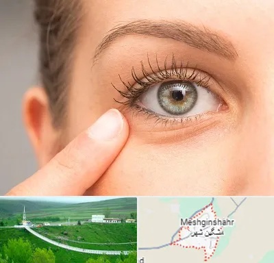 جراح پف چشم در مشگین شهر