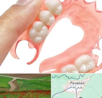 پروتز متحرک دندان در پارس آباد