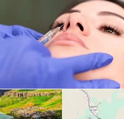 هیالاز در عجب شیر