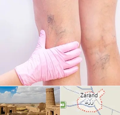 دکتر فوق تخصص واریس در زرند