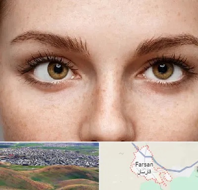 متخصص انحراف چشم در فارسان