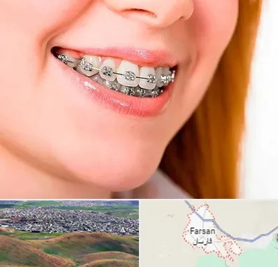 ارتودنسی ارزان در فارسان