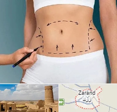 دکتر طب سنتی برای لاغری در زرند