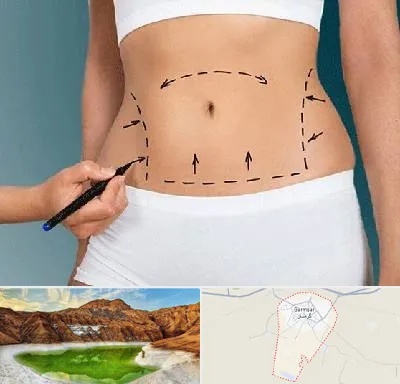 دکتر طب سنتی برای لاغری در گرمسار