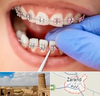 مرکز ارتودنسی دندان در زرند